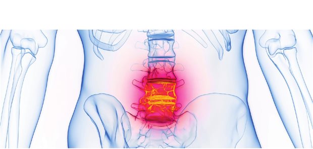 CRP-Wert-unabhängig therapieren mit Ixekizumab CRP-Wert-unabhängig therapieren mit Ixekizumab