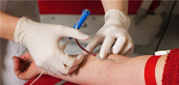 Was bringt die Messung von Lipoprotein(a)? Was bringt die Messung von Lipoprotein(a)?