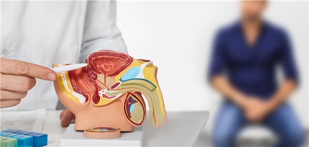 PSA-basiertes Prostatakrebs-Screening: Langzeitdaten belegen Nutzen Mit einem PSA-basierten Screening sollen Prostatakarzinome früh erkannt werden
