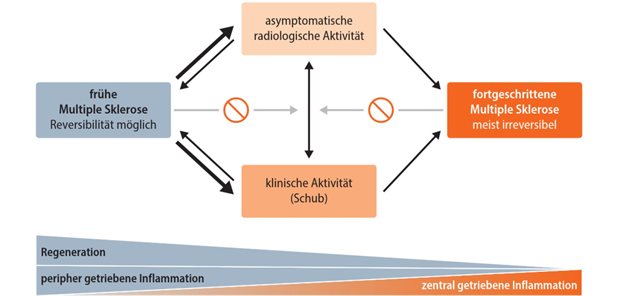 Praxisrelevante Daten im Fokus Abb. 1: MS-Krankheitsdynamik: Patientinnen und Patienten bewegen sich von frühen Stadien über Phasen fokaler Entzündung in fortgeschrittene, meist irreversible Stadien