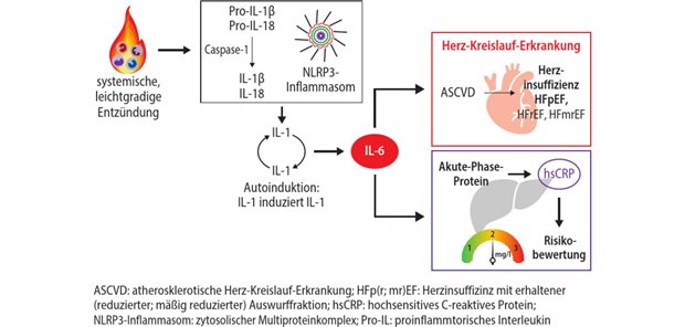 Therapie der kardiovaskulären Inflammation senkt das Risiko für kardiovaskuläre Ereignisse Abb. 1: Signalkaskade der kardiovaskulären Inflammation
