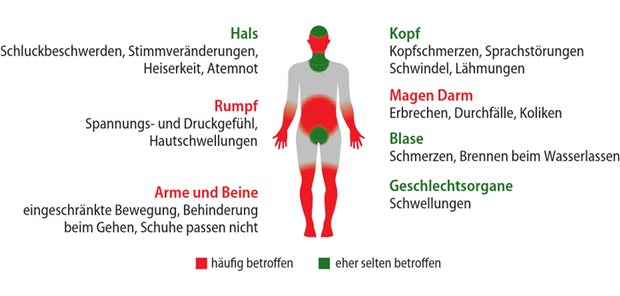 Erfolgreiches Krankheitsmanagement in der Schwangerschaft Abb. 1: Symptome und Merkmale des hereditären Angioödems