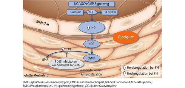 Riociguat: seit fünf Jahren zugelassen bei CTEPH und PAH Abb. 1: Wirkmechanismus von Riociguat