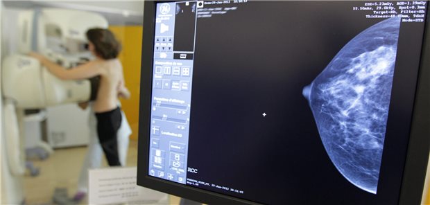 Mammographie-Screening ab 45 Jahren rückt in Sichtweite Frau bei der Mammographie.