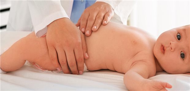 Juvenile idiopathische Arthritis: Bereits Babys können Rheuma bekommen Baby wird von einem Arrzt untersucht.