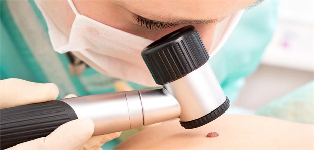 Hautkrebs-Screening in Deutschland laut Studie ohne klaren Nutzen Ein Hautarzt untersucht die Haut mit einem Dermatoskop auf Melanom.
