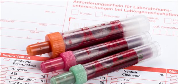 Wer diese Ausnahmeziffern kennt, rettet seinen Laborbonus Bei Laborleistungen sind die Ausnahmekennziffern mit zu beachten.
