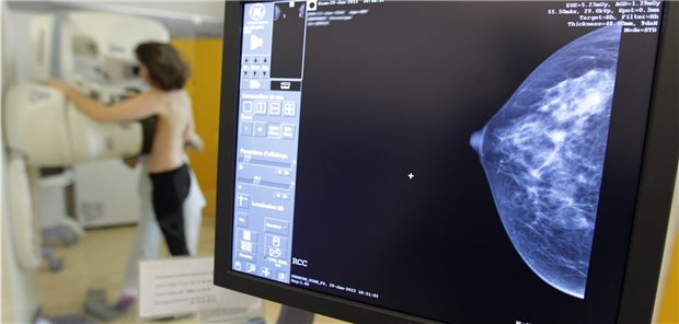 Algorithmen bleiben ärztliche Assistenz Bei Mammographien müssen Radiologen viele Bilder befunden. Das könnte ihnen in Zukunft zumindest teilweise eine KI-Applikation abnehmen.