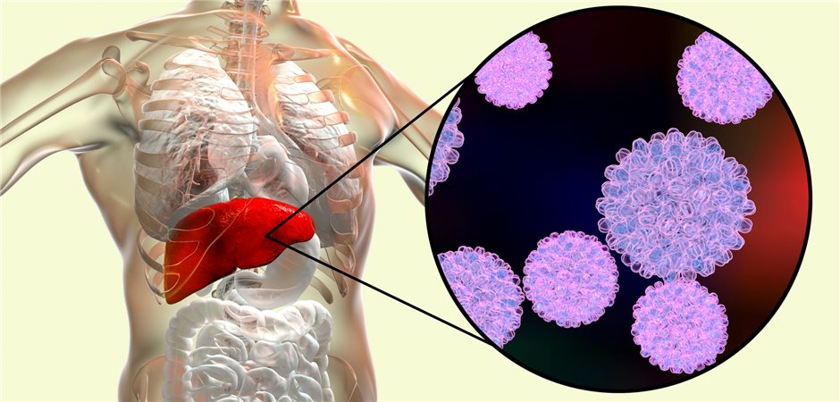 Chance Auf Funktionelle Heilung Bei Chronischer Hepatitis B?