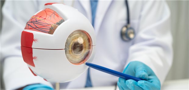 Januskinase-Hemmer als Gamechanger bei therapierefraktärer endokriner Orbitopathie Ein Arzt erklärt einem Patienten anhand eines Modell der menschlichen Anatomie des Auges die Behandlung der endokrine Orbitopathie (EO) einer entzündlich-fibrosierenden Autoimmunerkrankung der Augenhöhle.