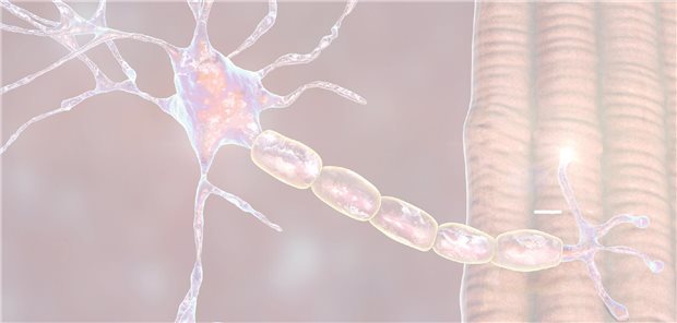 Real-World-Datena bestätigten Ravulizumab in der klinischen Praxis Real-World-Datena bestätigten Ravulizumab in der klinischen Praxis