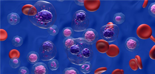 Langfristig überlegen: Kombinationen mit Daratumumab in der Erstlinie Langfristig überlegen: Kombinationen mit Daratumumab in der Erstlinie