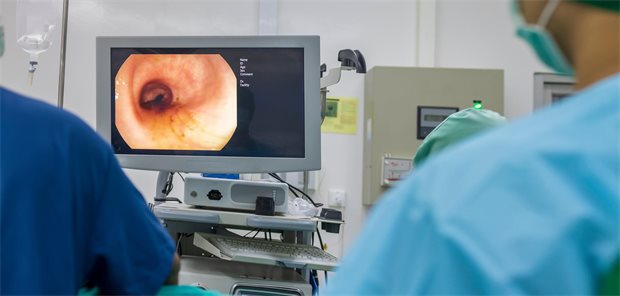Darmkrebs: Ist die koloskopische Überwachung falsch aufgestellt? Koloskopie, Blick auf den Monitor