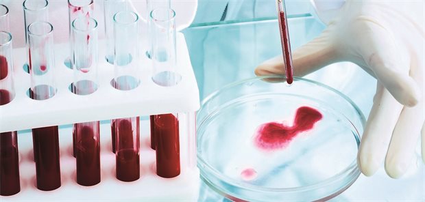 Neuer Ansatz für eine Alzheimer-Diagnostik mittels Bluttests Bluttest