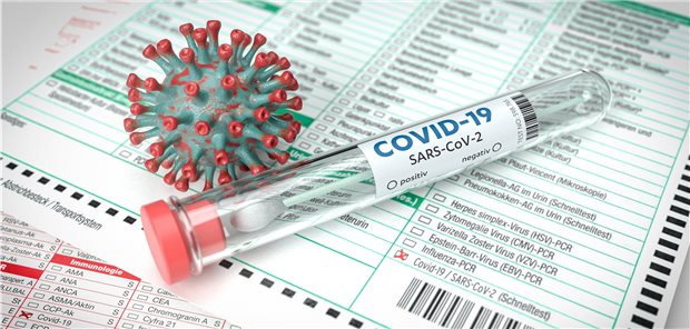 Medizin-Personal soll wöchentlich getestet werden Brandenburg stellt 4 Millionen Euro für Corona-Tests von asymptomatischen Personen zur Verfügung.