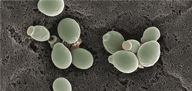 Pilzinfektionen: So steht es um die Resistenzen Elektronenmikroskopische Aufnahme von Candida albicans.
