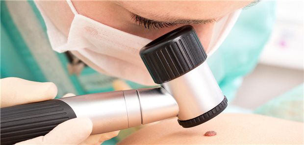 Hautkrebs-Screening als Kassenleistung nur mit Genehmigung der KV Untersuchung der Haut