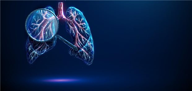 Lungenkrebs-Screening: Zufällige Befunde können auf extrapulmonale Tumoren hinweisen Eine Illustration einer Lunge mit einer Lupe.