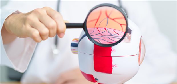 Wie sehr senken GLP-1-Rezeptor-Agonisten bei adipösen Menschen das Risiko für eine Makuladegeneratio Ein Arzt mit einem Modell des menschlichen Auges hebt mit einer Lupe die Netzhaut hervor, die im Rahmen einer Makuladegeneration beschädigt wird.