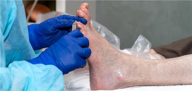 Was lange Zehennägel bei älteren Patienten über die Gesundheit verraten Ein medizinischer Pfleger schneidet einem älteren Patienten in der Klinik die langen Fußnägel.