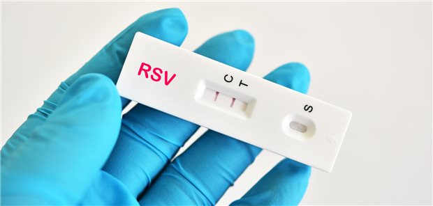 Ambulante Antibiotikaverordnungen bei Kindern einsparen mit RSV-Schnelltests? Positives RSV-Testergebnis unter Verwendung eines Antigen-Testkits für das Respiratorische Synzytial-Virus (RSV).