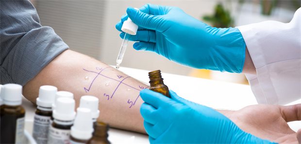Allergiediagnostik: Dos und Don’ts für die Hausarztpraxis Eine Ärztin tropft Allergielösung auf den präparierten Unterarm einer Patientin für den Pricktest.
