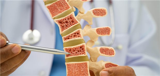GC-induzierte Osteoporose: DXA zeitnah mit Beginn der Therapie! Arzt zeigt Knochenstruktur an einem HWS-Modell