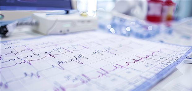 EKG-Aufzeichnungen auf Papier dargestellt und auf weißem Hintergrund angezeigt. Sie werden verwendet um den Herzrhythmus zu analysieren und die Wirksamkeit der Behandlung von Herzkrankheiten zu verfolgen.