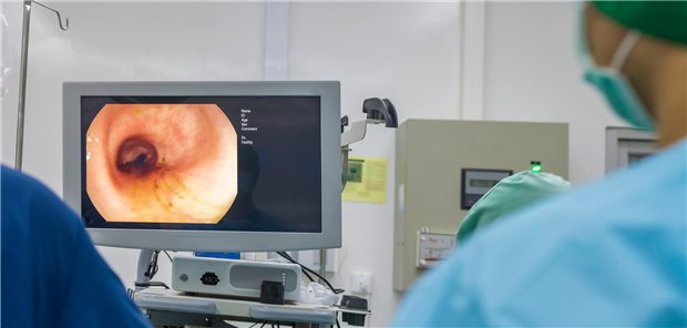 Darmkrebsscreening: FIT oder Koloskopie – wer hat die Nase vorn? Die Koloskopie ist invasiv, kann aber Krebsvorstufen erkennen. Mit dem FIT hingegen lassen sich nur Tumoren im frühen Stadium detektieren.