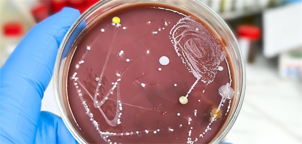 Pilzinfektionen in der Hämatologie/Onkologie: So gehen Sie vor Eine Agarplatte mit angewachsenen Pilzkolonien.