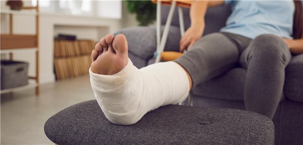 Bei Weber-B-Fraktur: Gips ebenbürtig mit Operation Patientin mit gebrochenem Knöchel, der durch einen Gipsverband immobilisiert ist, sitzt auf dem Sofa und legt ihr Bein hoch.
