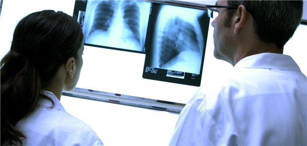 Neue S3-Leitlinie: Mehr Struktur fürs Tuberkulose-Screening Zwei Ärzte schauen sich zwei Röntgenaufnahmen eines Thorax an.