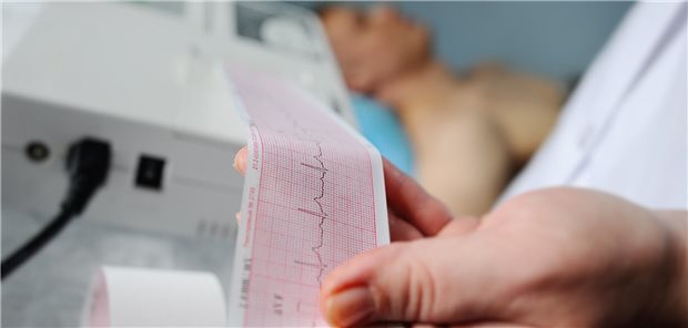 Auffälliges EKG: Was steckt hinter diesen 13 Fällen? Ein Arzt schaut sich ein EGK an.