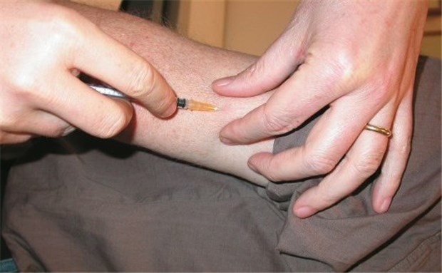 Hyposensibilisierung auch bei Asthma Ein Allergenextrakt wird injiziert; die Wirksamkeit der subkutanen Immuntherapie ist bereits in vielen Studien nachgewiesen.