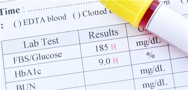 Frühe HbA1c-Kontrolle zahlt sich aus Ergebnisse der Blutanalyse zur Bestimmung des HbA1c Wertes und des Blutzuckers eines Patienten