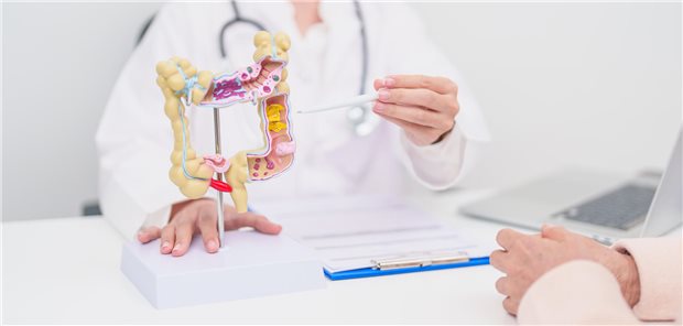 Divertikulitis: Wann konservativ, wann chirurgisch behandeln? Eine Patientin konsultiert ihre Ärztin zur Klärung des Stadium ihrer Divertikulitis und den Therapieoptionen.