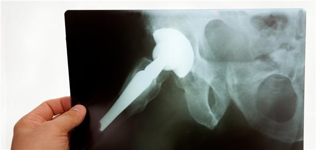 Bildgebung mit Implantat