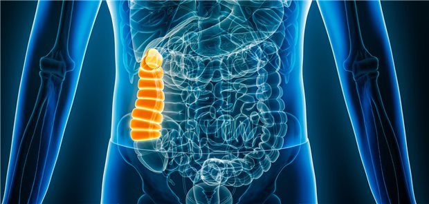 Starker Verdacht auf Kolonkrebs – und das steckte dahinter Dreidimensionale Darstellung einer Röntgenaufnahme der Vorderansicht eines Menschen mit Körperkonturen und farblich hervorgehobenen aufsteigenden Dickdarm.