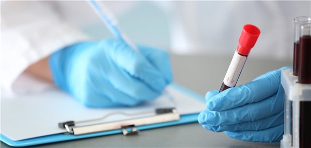 Bluttest könnte Alzheimerbeginn vorhersagen Eine Ärztin fühlt an einem Tisch einen Zettel für die Untersuchung einer von ihr entnommenen Blutprobe durch.