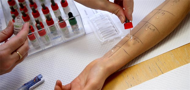 Allergologe: „Die meisten Patienten mit Allergien kann man gut in der Hausarztpraxis untersuchen“ Auf einen Unterarm wird auf verschiedene Stellen Allergenlösung geträufelt für den Pricktest.
