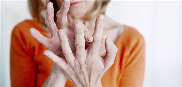Wartezimmerplakate bieten Rheuma-Wissen to go Geschwollene Finger? Dieses und andere Symptome werden in den Informationsmaterialien für die Patienten erläutert.