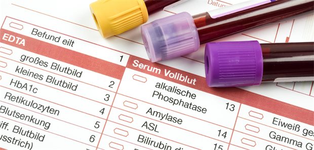 5 Beispiele: Welche Laborwerte wichtig sind – und welche überflüssig Große Auswahl: Welche die richtige ist, entscheiden Anamnese und klinischer Befund.