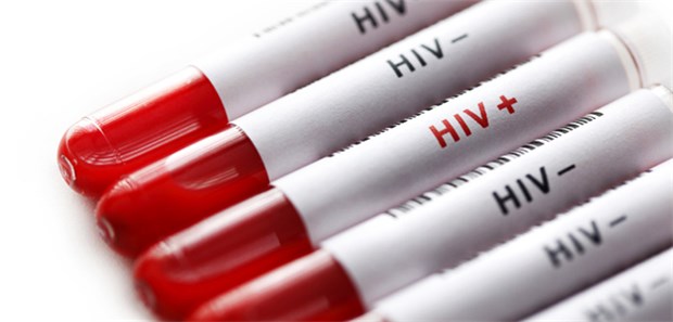 Kein Erhöhtes Hiv Risiko Bei Verhütungsspritzen 