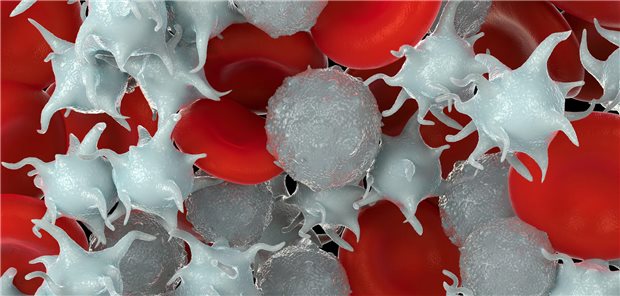 Gastrointestinale Tumoren: Avatrombopag hilft bei chemotherapieinduzierter Thrombozytopenie
Hält eine chemotherapieinduzierte Thrombozytopenie an, kann das die Chemotherapie verzögern und somit das Outcome eventuell verschlechtern.