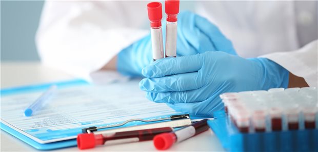 Diese fünf Biomarker weisen auf Multimorbidität hin 5 Blutproben in Röhrchen