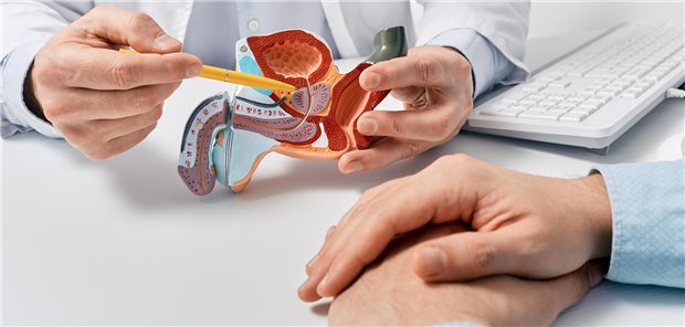 Risikoadaptiert auf Prostatakrebs screenen – geht das? Nahaufnahme eins Arztes der anhand eines anatomischen Modell des männlichen Fortpflanzungssystems einem männlichen Patienten die Maßnahmen des risikoadaptieren Prostatascreening erklärt.