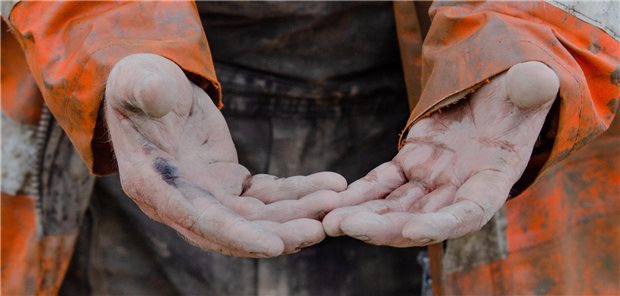 Berufliche Hautmittel: Aktualisierte Empfehlungen auf S2k-Niveau Ein Bauarbeiter zeigt seine schmutzigen, angegriffenen Hände.