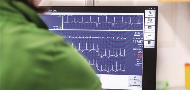 KI im Alltags-Check: So urteilen zwei Kollegen KI-gestütztes EKG