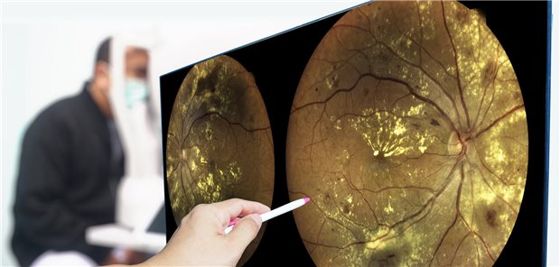 Augenchecks für Diabetiker: DIVA‑Projekt startet an acht Standorten in Thüringen Eine Retina-Aufnahme wird befundet.