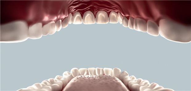 Orale Mucositis nach Krebstherapie: Tipps zur Prävention und Behandlung Ein Mund von innen